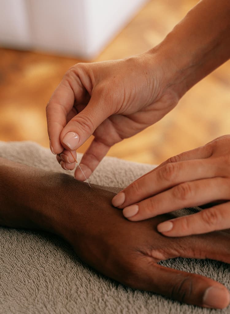 Dry Needling Rehabilitation