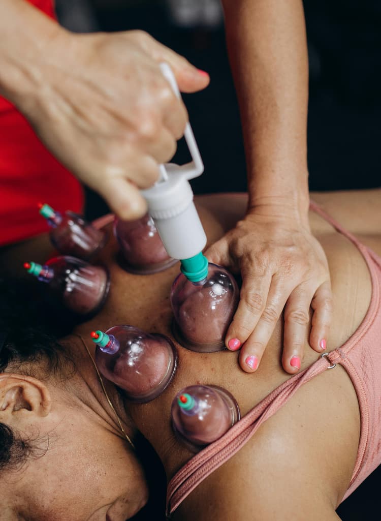 Cupping Rehabilitation
